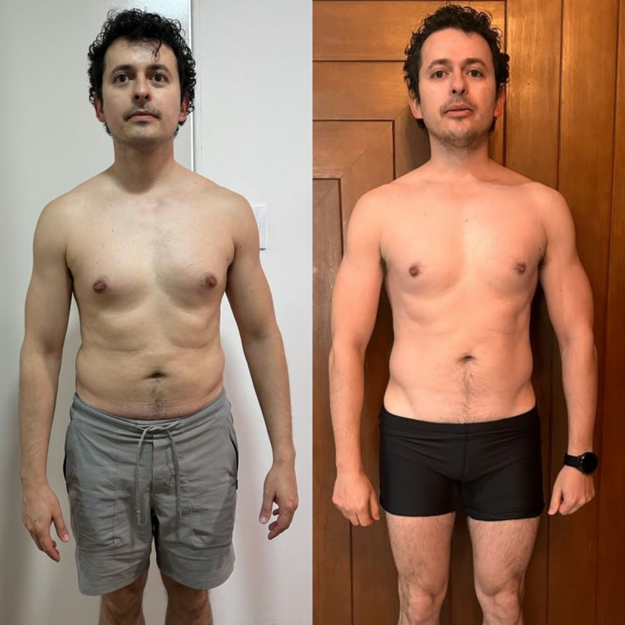 Antes y después: Bernardo
