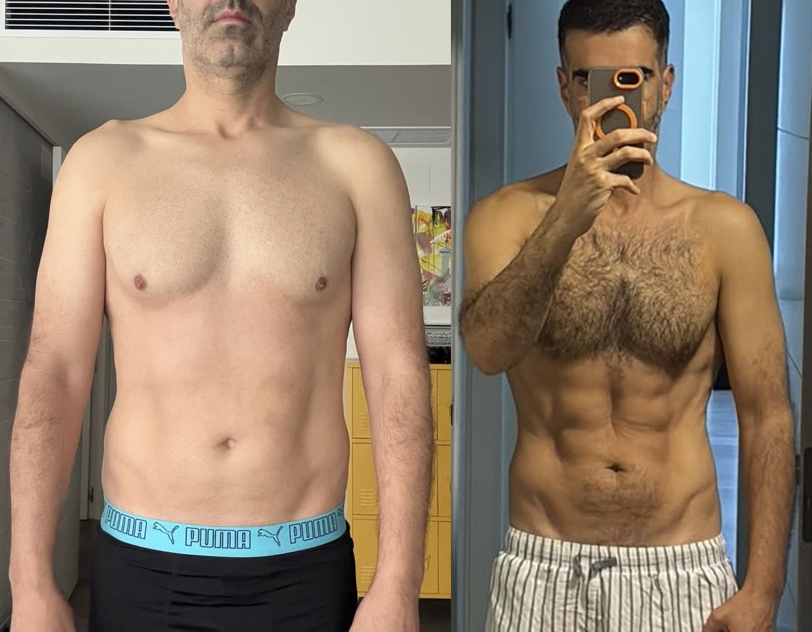 Luis: antes y después