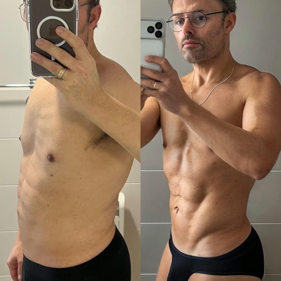 Antes y después: Manuel Pedroche