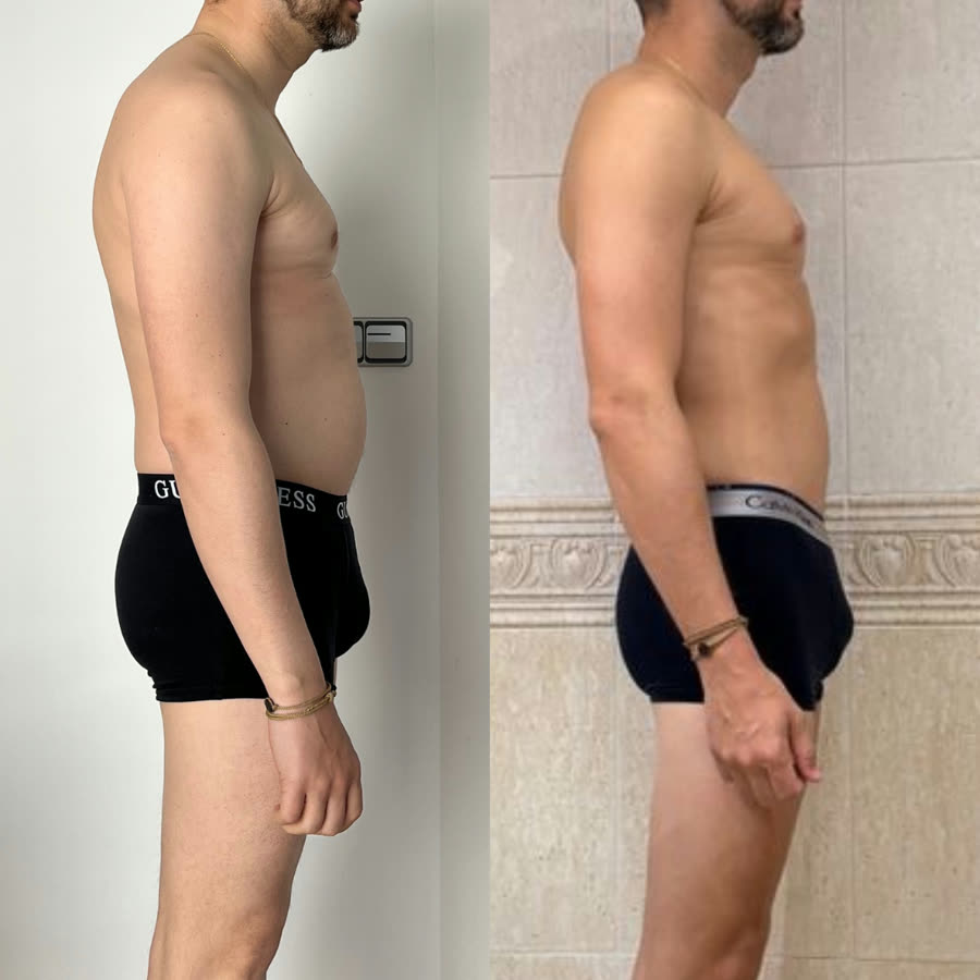 Antes y después: Sergio Felici